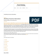 22 Maxillary Posterior Edentulism - Pocket Dentistry