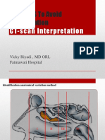 Safe FESS To Avoid Complication: CT-scan Interpretation