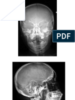 Sectiuni Si Radiografii - An I, Sem 2