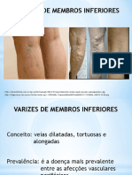 Varizes de Membros Inferiores e DVC 3