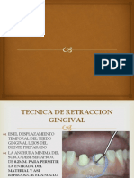 Tecnica de Retraccion Gingival y Tecnicas Retractivas