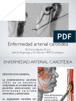 Enfermedad Carotídea PDF