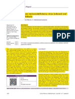 Human Immunodeficiency Virus Induced Oral Candidiasis: Ental Science - Case Report