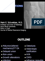 Fracture Complication