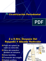 Cicatrización Periodontal