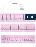 Ecg Practice Test