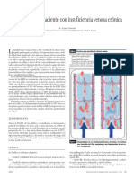 Insuficiencia Venosa Critica PDF