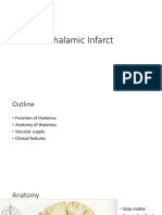 Thalamus Infarct and Clinical Presentation