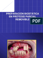 Preparación de La boca-PPR