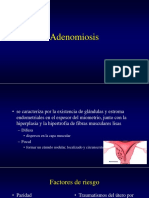 Adenomiosis