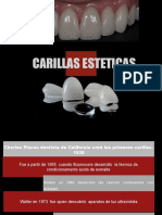 Carillas Esteticas