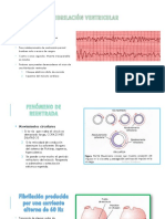 Fibrilación Ventricular