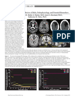 Post-Traumatic Epilepsy (JNCN 2014-Summer)