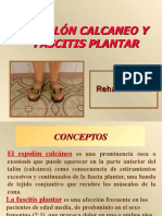 Espolon Calcaneo y Fascitis Plantar