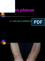 Lichen Planus