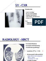 Bronchiectasis 2