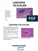 Linfoma Folicular 1