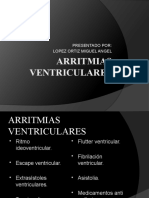 Arritmias Ventriculares