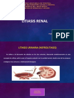 Litiasis Renal