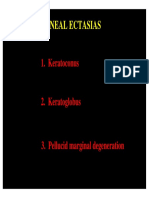 18 Corneal Ectasias