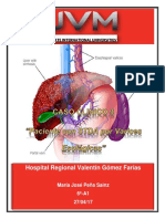 Caso Clinico Varices Esofagicas