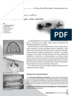 Dokumen - Tips Sobredentaduras A Pernos Tapa o Ataches en Bola