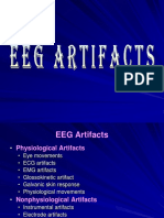 EEG Artifacts