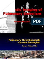 Diagnostic Imaging of Pulmonary Embolism: Shane Bezzant