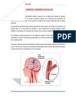 Accidente Cerebrovascular