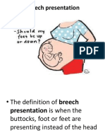 Breech Presentation