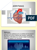 Arritmias