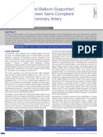 Catheter-Assisted Balloon-Supported Retrieval of A Broken Semi-Compliant Balloon From A Coronary Artery