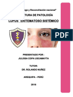 Lupus Eritematoso Sistémico