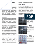 Meningioma y Su Tratamiento Quirurgico
