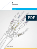 Acumed Surgical Technique ES Hand Fracture System ESHNW10 07 B