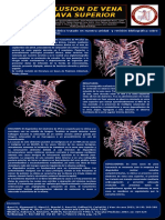 Poster Oclusion Vena Cava Superior