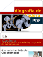 Radiografia Cadera