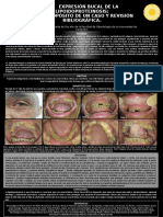 MANIFESTACIONES BUCALES Y SISTÉMICAS DE LA LIPOIDOPROTEINOSIS Final