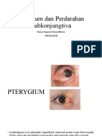 Pterigium Dan Pendarahan Subkonjungtiva