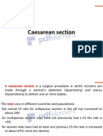 Caesarean Section4817080565385082090