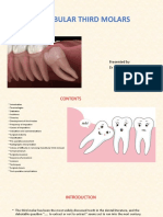 Bhanu Impaction Seminar Final