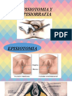 Episiotomia Y Episiorrafia