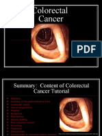 Colon Cancer