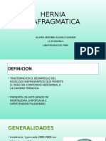 Hernia Diafragmatica