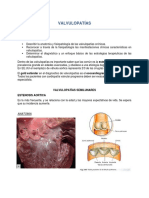 Valvulopatías