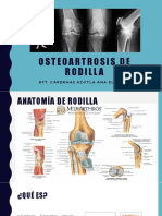 OSTEOARTROSIS