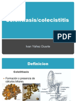 COLECISTITIS