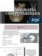 Exposicion Tomografia Computarizada