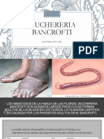 Wuchereria Bancrofti PDF