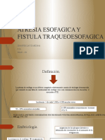 Atresia Esofagica y Fistula Traqueoesofagica